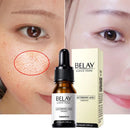 Soro facial de vitamina C e Retinol anti rugas e clareador