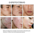 Soro facial de vitamina C e Retinol anti rugas e clareador