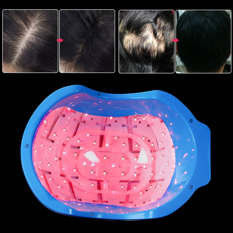 Capacete laser terapia de tratamento Anti Queda de cabelo