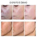 Soro facial de vitamina C e Retinol anti rugas e clareador