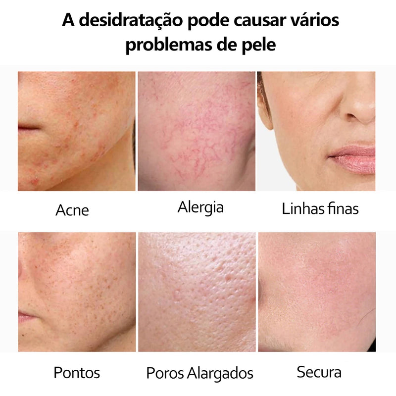 Soro facial de vitamina C e Retinol anti rugas e clareador