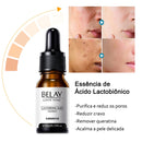 Soro facial de vitamina C e Retinol anti rugas e clareador