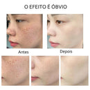 Soro facial de vitamina C e Retinol anti rugas e clareador