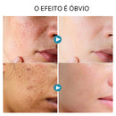 Soro facial de vitamina C e Retinol anti rugas e clareador