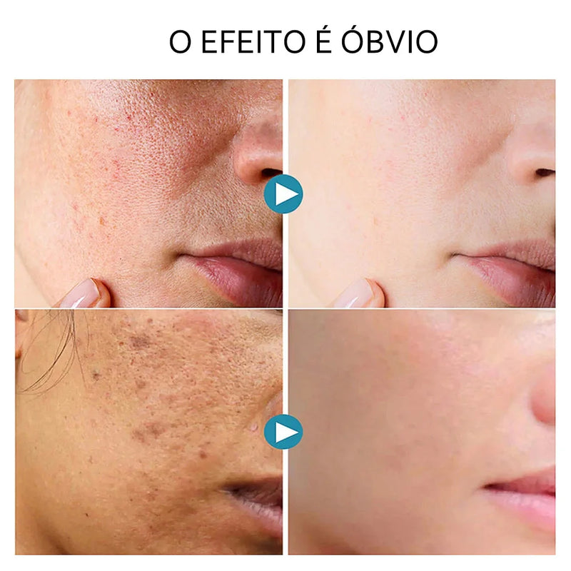 Soro facial de vitamina C e Retinol anti rugas e clareador